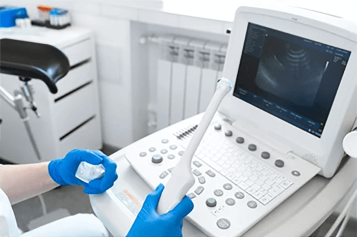 gynaecology equipment